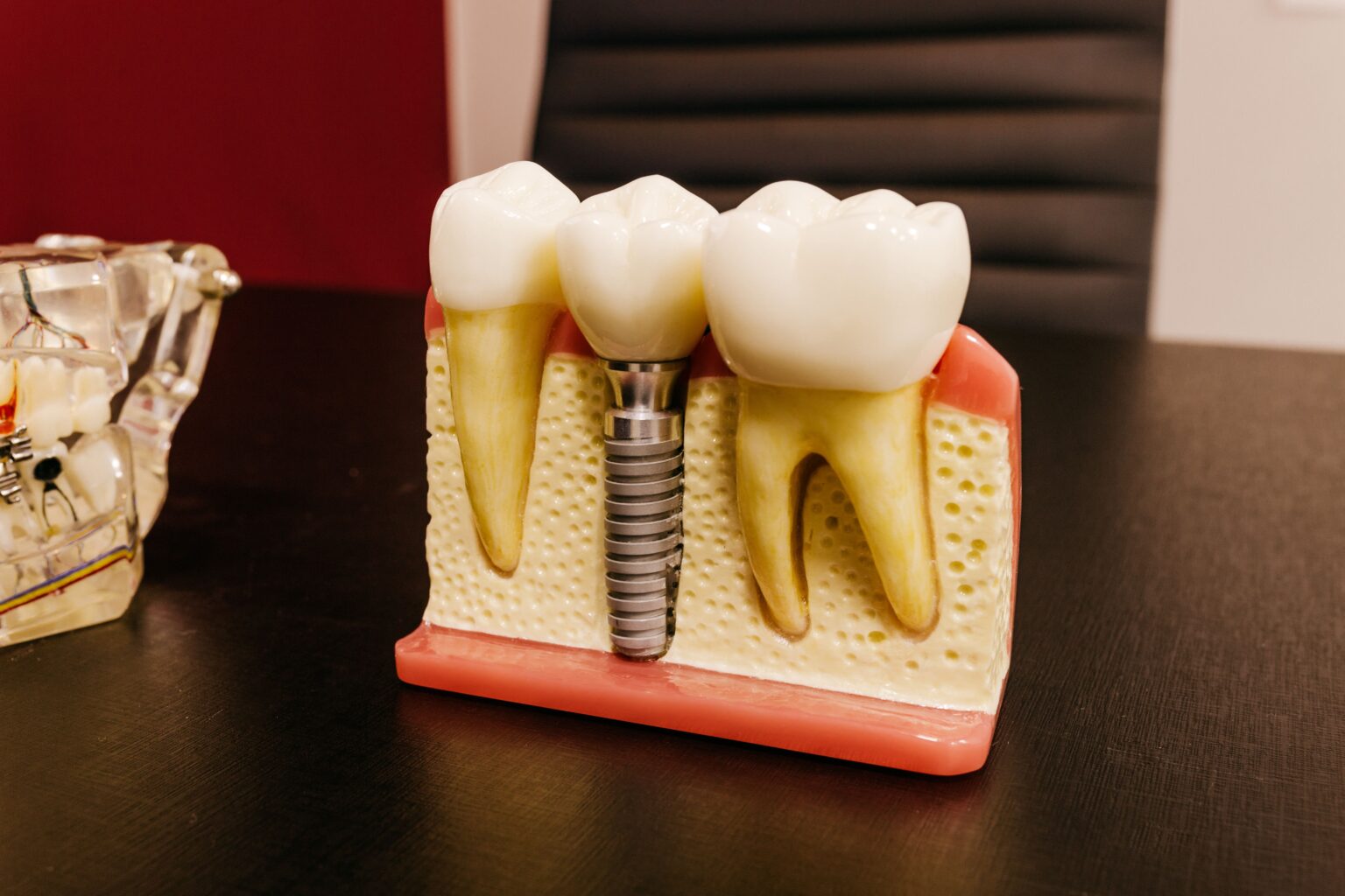 Why Understanding Dental Implant Cost Matters Before Treatment